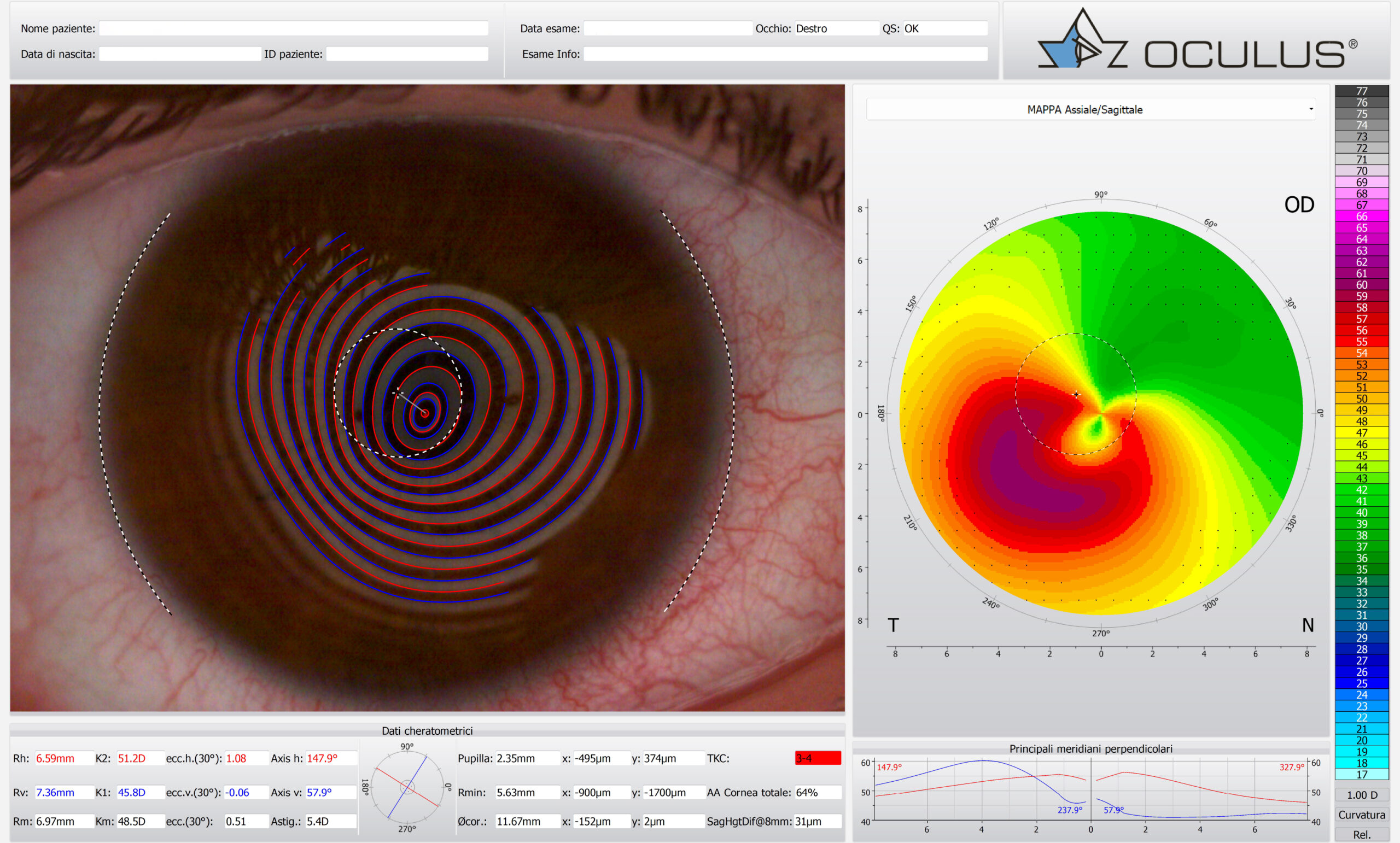 Topografia corneale a Roma