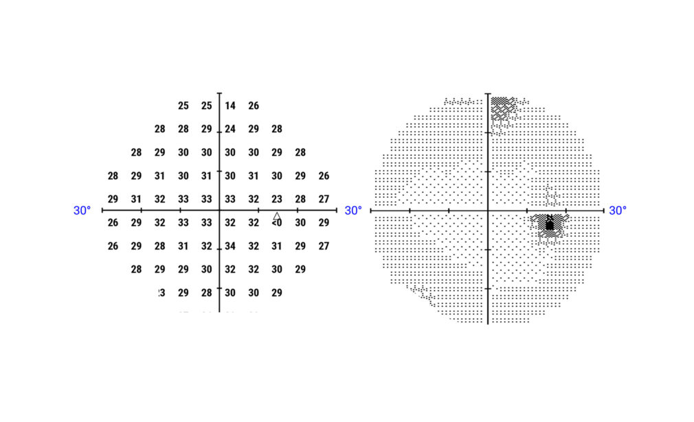 Campo Visivo Computerizzato e Manuale