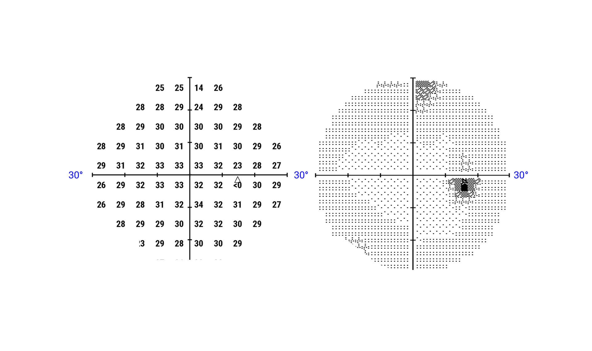 Campo Visivo Computerizzato e Manuale